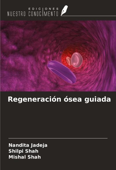 Regeneración ósea guiada