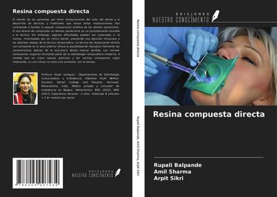 Resina compuesta directa