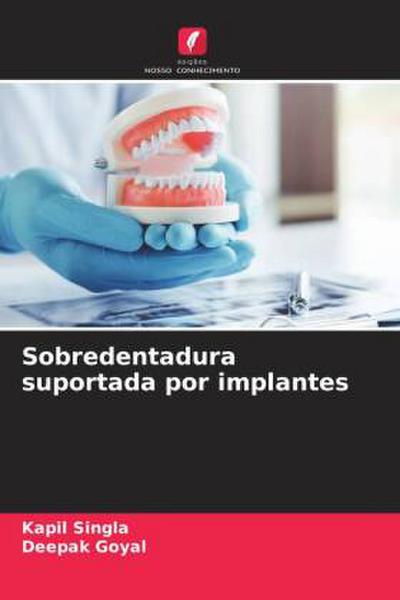 Sobredentadura suportada por implantes