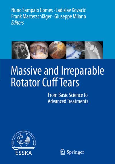 Massive and Irreparable Rotator Cuff Tears