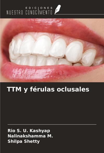 TTM y férulas oclusales