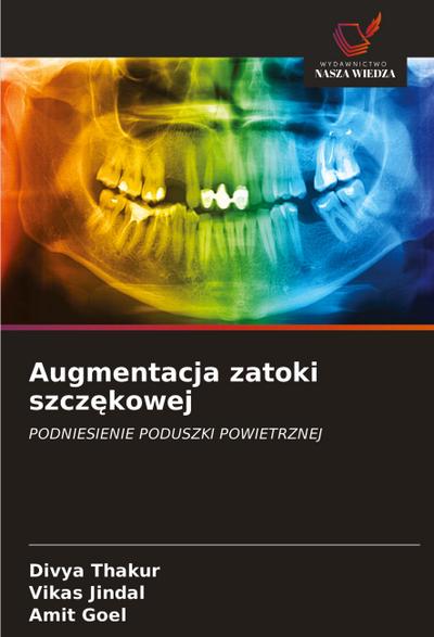 Augmentacja zatoki szcz¿kowej