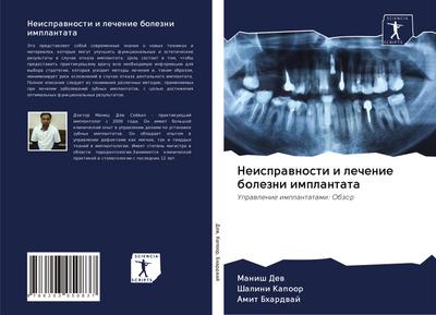 Neisprawnosti i lechenie bolezni implantata