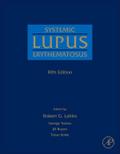 Systemic Lupus Erythematosus