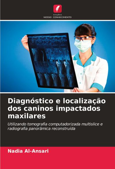 Diagnóstico e localização dos caninos impactados maxilares