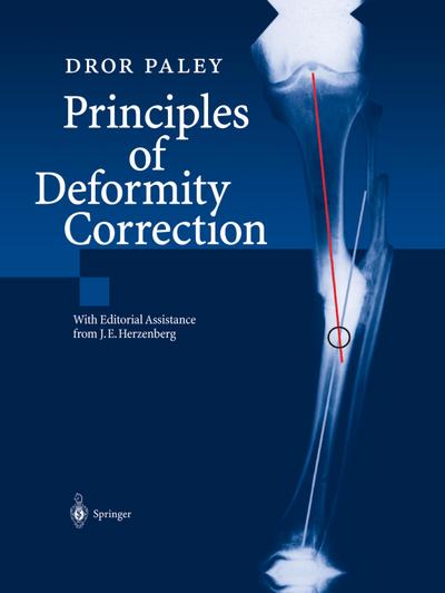 Principles of Deformity Correction