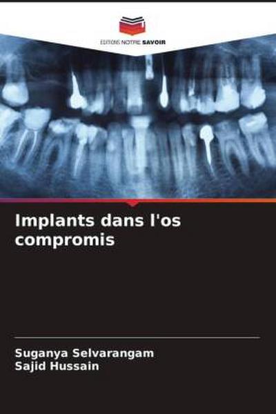 Implants dans l’os compromis