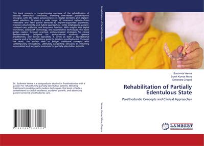 Rehabilitation of Partially Edentulous State