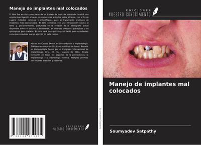 Manejo de implantes mal colocados