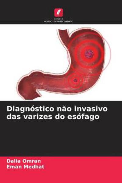 Diagnóstico não invasivo das varizes do esófago
