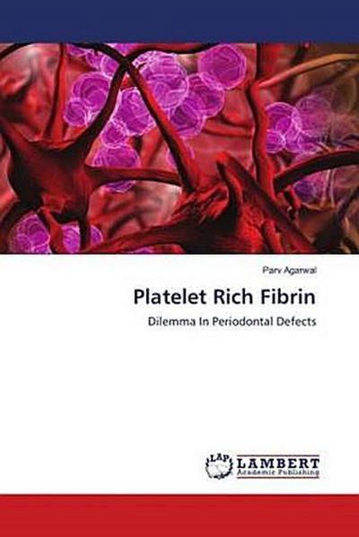 Platelet Rich Fibrin