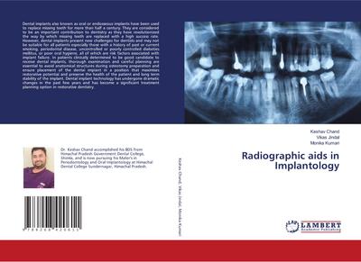 Radiographic aids in Implantology