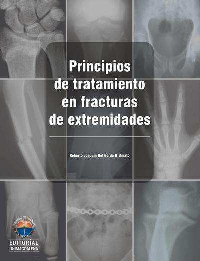 Principios de tratamiento en fracturas de extremidades