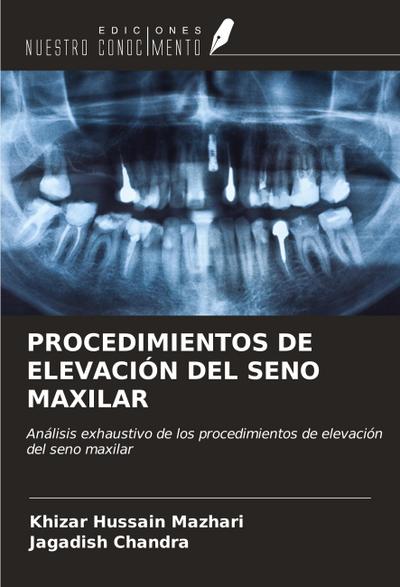 PROCEDIMIENTOS DE ELEVACIÓN DEL SENO MAXILAR