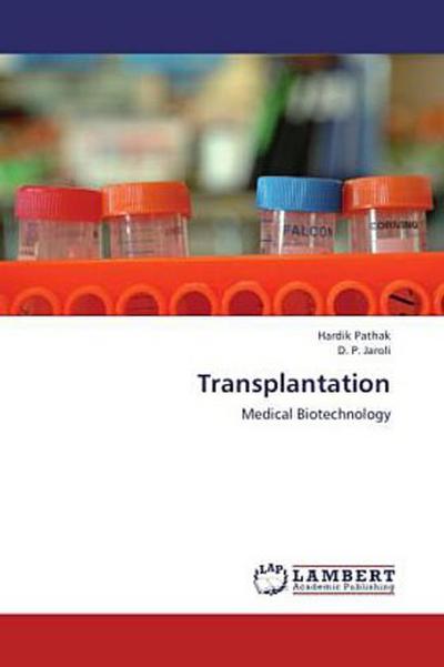 Transplantation