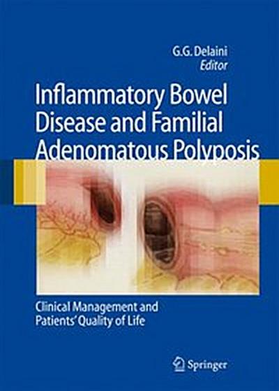 Inflammatory Bowel Disease and Familial Adenomatous Polyposis