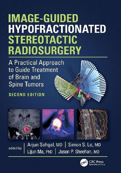 Image-Guided Hypofractionated Stereotactic Radiosurgery