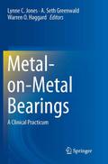 Metal-on-Metal Bearings