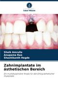 Zahnimplantate im ästhetischen Bereich