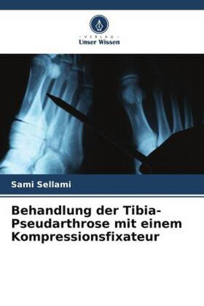 Behandlung der Tibia-Pseudarthrose mit einem Kompressionsfixateur