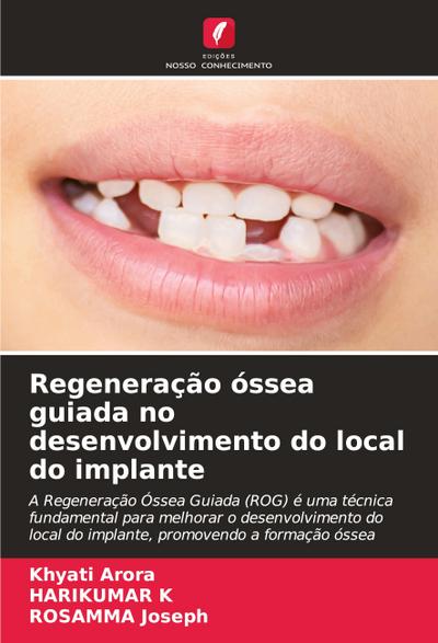 Regeneração óssea guiada no desenvolvimento do local do implante