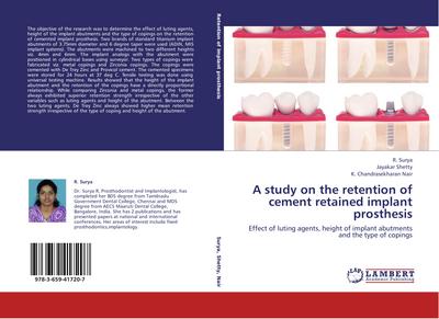 A study on the retention of cement retained implant prosthesis