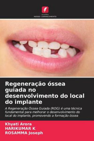 Regeneração óssea guiada no desenvolvimento do local do implante