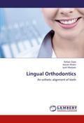 Lingual Orthodontics