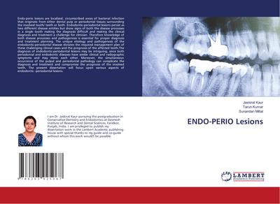 ENDO-PERIO Lesions