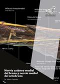 Nervio cutáneo medial del brazo y nervio medial del antebrazo