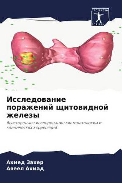 Issledowanie porazhenij schitowidnoj zhelezy