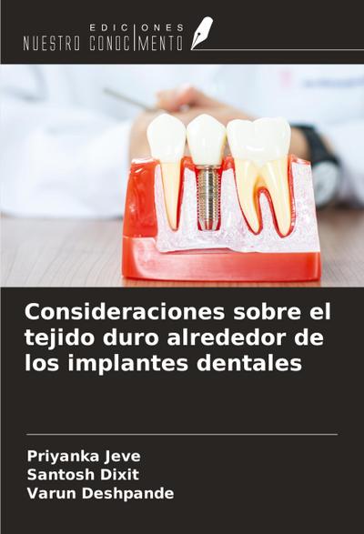 Consideraciones sobre el tejido duro alrededor de los implantes dentales