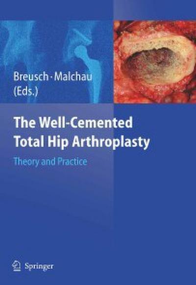 The Well-Cemented Total Hip Arthroplasty