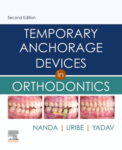 Temporary Anchorage Devices in Orthodontics E-Book