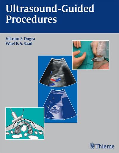 Ultrasound-Guided Procedures