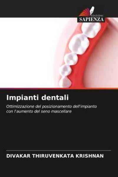 Impianti dentali