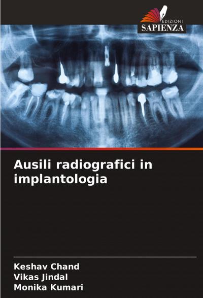 Ausili radiografici in implantologia