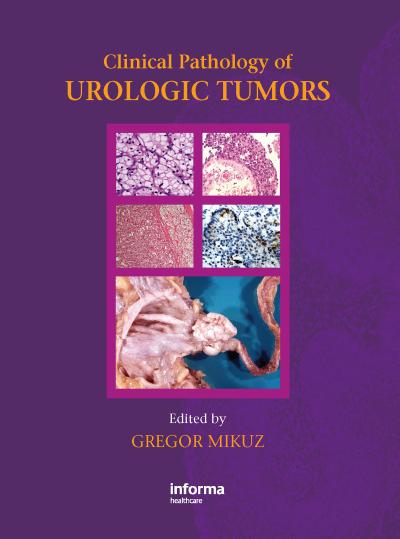Clinical Pathology of Urological Tumours