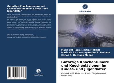 Gutartige Knochentumore und Knochenläsionen im Kindes- und Jugendalter