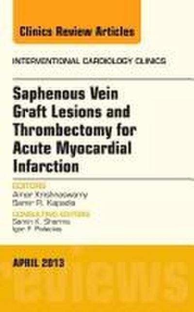 Saphenous Vein Graft Lesions and Thrombectomy for Acute Myocardial Infarction, an Issue of Interventional Cardiology Clinics