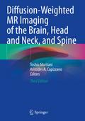 Diffusion-Weighted MR Imaging of the Brain, Head a