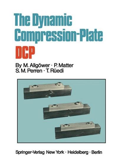Dynamic Compression Plate DCP