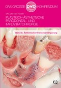 Plastisch-Ästhetische Parodontal- und Implantatchirurgie - Otto Zuhr