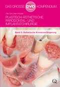 Plastisch-Ästhetische Parodontal- und Implantatchirurgie