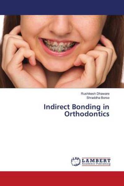 Indirect Bonding in Orthodontics