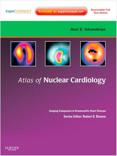 Atlas of Nuclear Cardiology: Imaging Companion to Braunwald’s Heart Disease E-Book