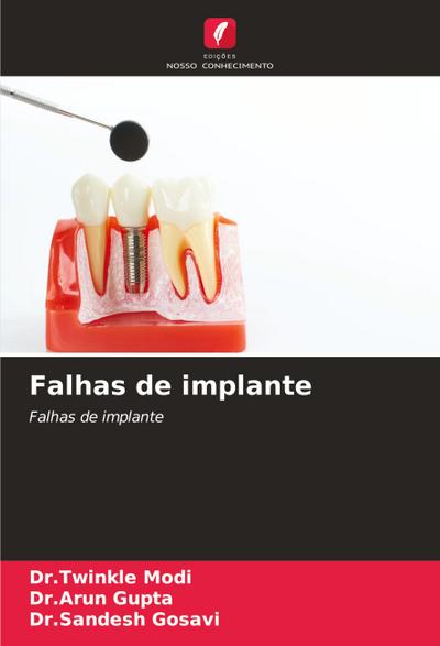 Falhas de implante