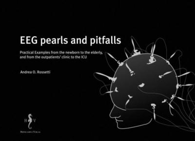 EEG pearls and pitfalls