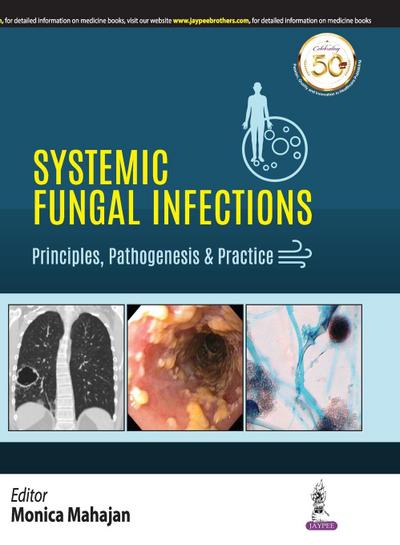Systemic Fungal Infections