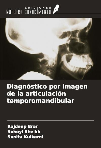 Diagnóstico por imagen de la articulación temporomandibular